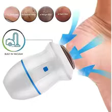 Hot Selling Portable Electric USB Foot Grinder Foot File Dead Skin Callus Remover for Dry, Hard, Cracked, Dead Skin