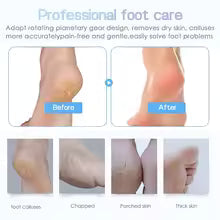 Electronic foot care tools, callus remover, decalc remover, dead skin remover, electric foot grinder