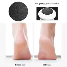 Hot Selling Portable Electric USB Foot Grinder Foot File Dead Skin Callus Remover for Dry, Hard, Cracked, Dead Skin